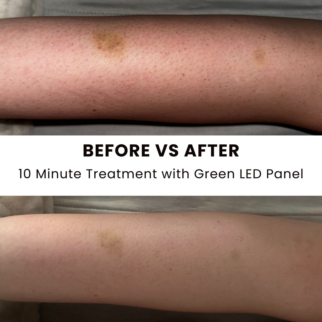 Illuminate Green LED Light Therapy Panel